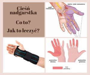 Zespół cieśni nadgarstka